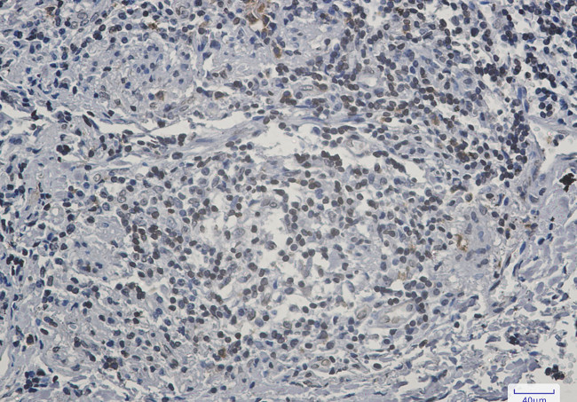 Lamin B Receptor Antibody in Immunohistochemistry (Paraffin) (IHC (P))
