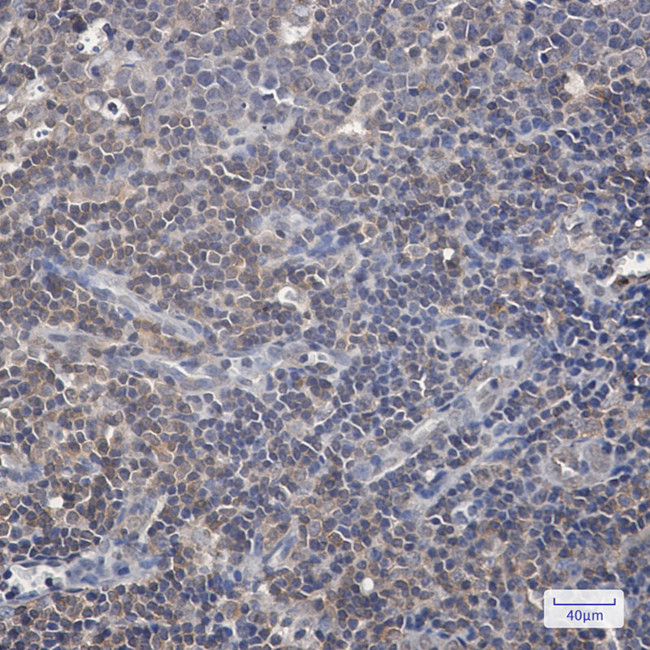 Phospho-c-Raf (Ser259) Antibody in Immunohistochemistry (Paraffin) (IHC (P))