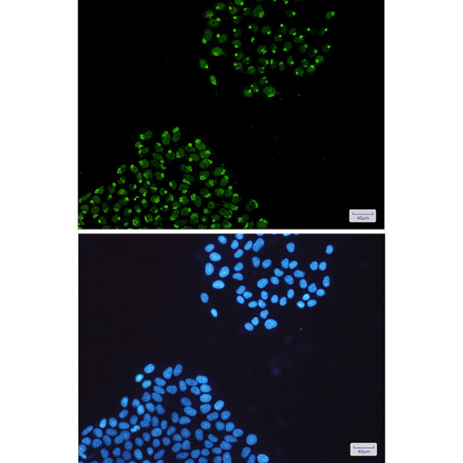 HnRNP Q Antibody in Immunocytochemistry (ICC/IF)