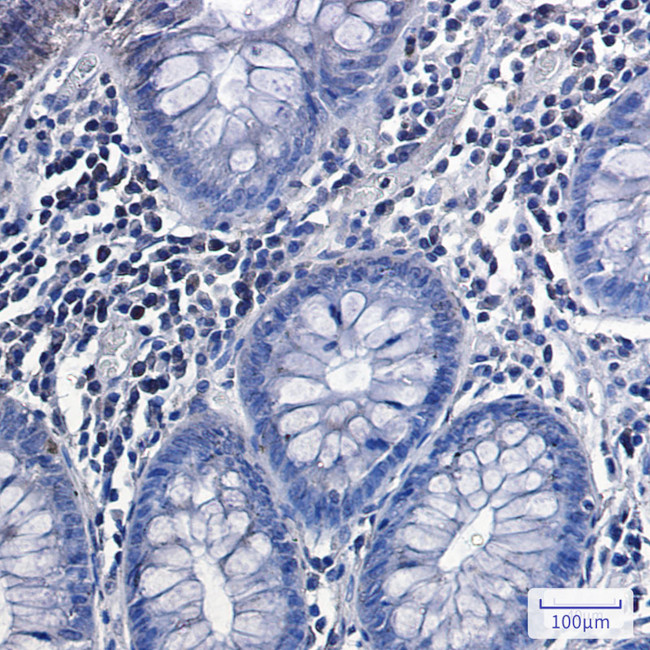Phospho-GYS1 (Ser641) Antibody in Immunohistochemistry (Paraffin) (IHC (P))