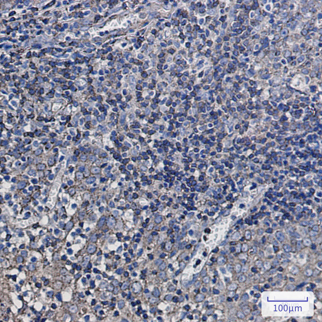 SYPL1 Antibody in Immunohistochemistry (Paraffin) (IHC (P))