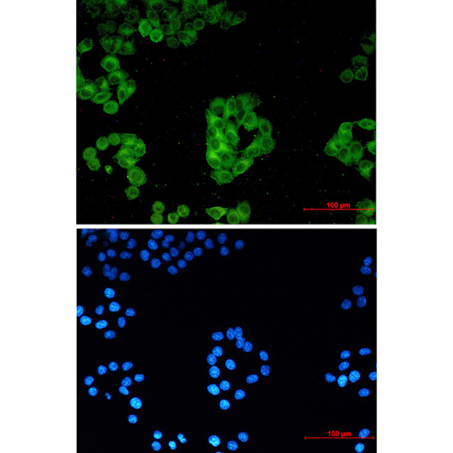 Cytochrome P450 Reductase Antibody in Immunocytochemistry (ICC/IF)