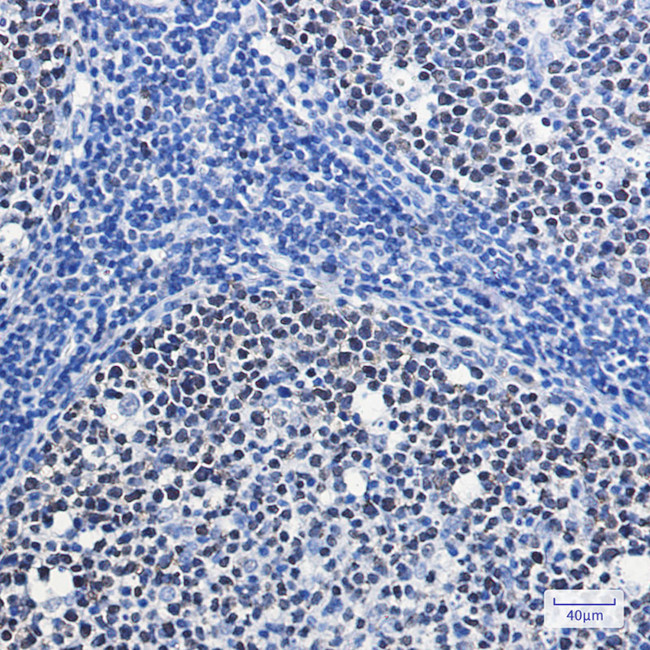 MCM7 Antibody in Immunohistochemistry (Paraffin) (IHC (P))