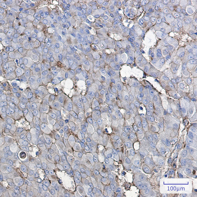 GNAQ Antibody in Immunohistochemistry (Paraffin) (IHC (P))