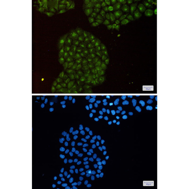 PSMB8 Antibody in Immunocytochemistry (ICC/IF)