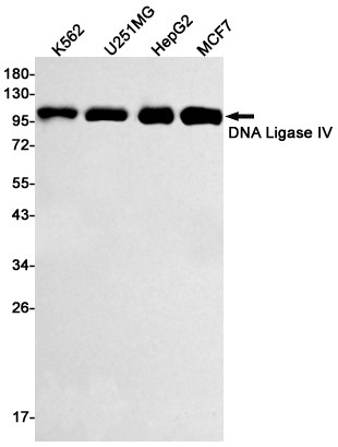 DNA ligase IV Antibody in Western Blot (WB)