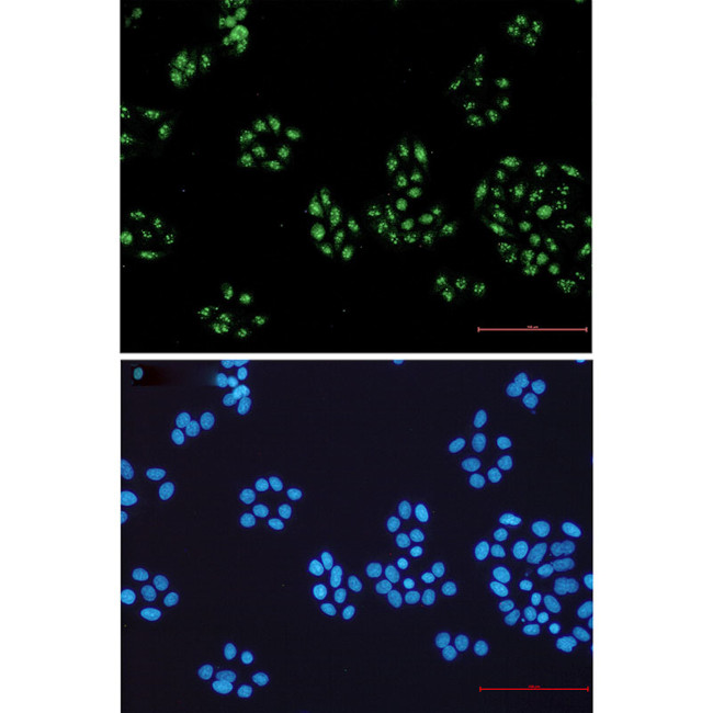 NOLC1 Antibody in Immunocytochemistry (ICC/IF)