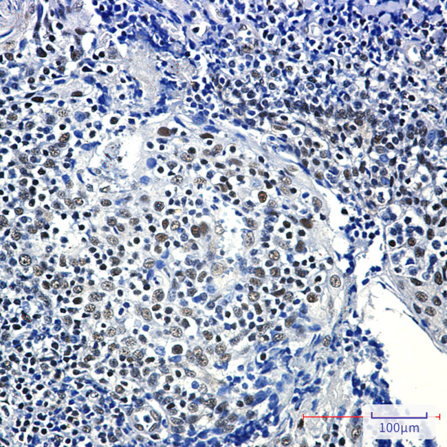 RPA2 Antibody in Immunohistochemistry (Paraffin) (IHC (P))