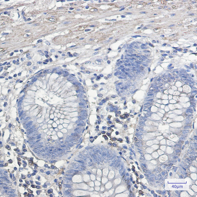 IL11RA Antibody in Immunohistochemistry (Paraffin) (IHC (P))