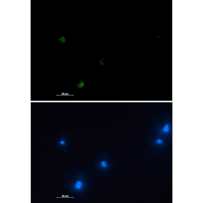 NUDT19 Antibody in Immunocytochemistry (ICC/IF)