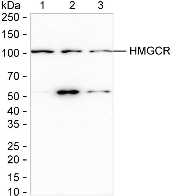 HMGCR Antibody in Western Blot (WB)