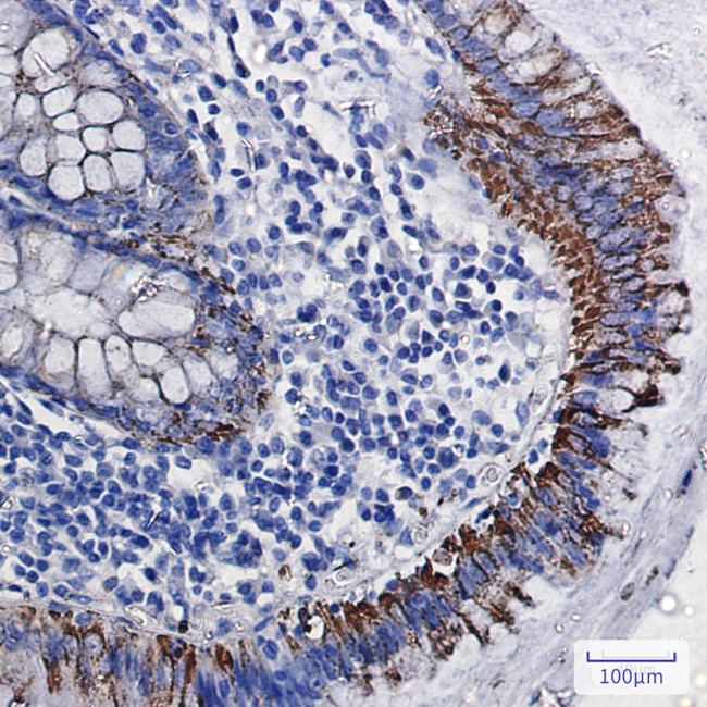 MAOA Antibody in Immunohistochemistry (Paraffin) (IHC (P))