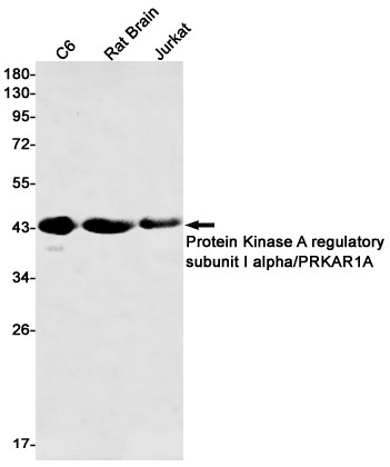 PRKAR1A Antibody in Western Blot (WB)