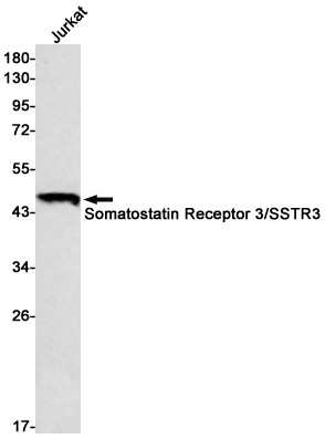 SSTR3 Antibody in Western Blot (WB)