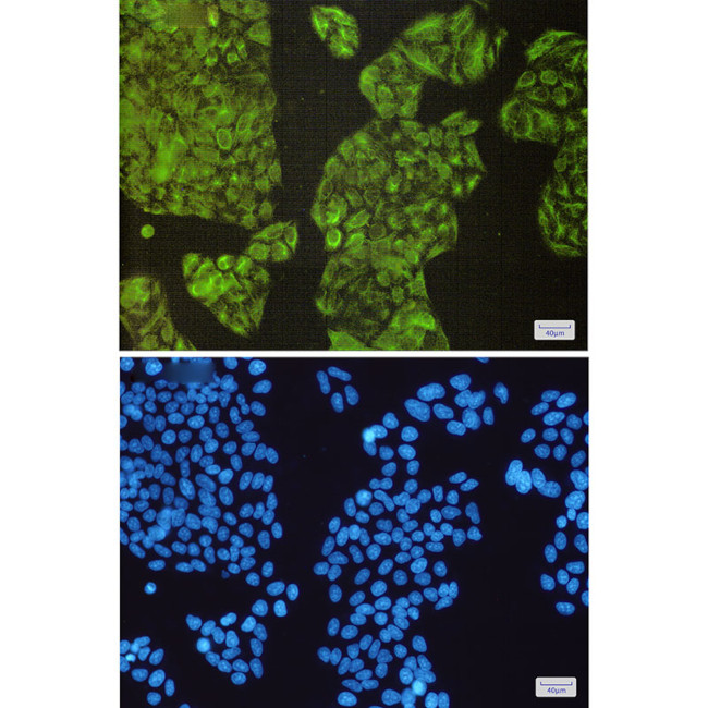 NCK2 Antibody in Immunocytochemistry (ICC/IF)