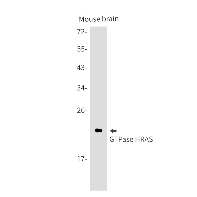N-Ras Antibody in Western Blot (WB)