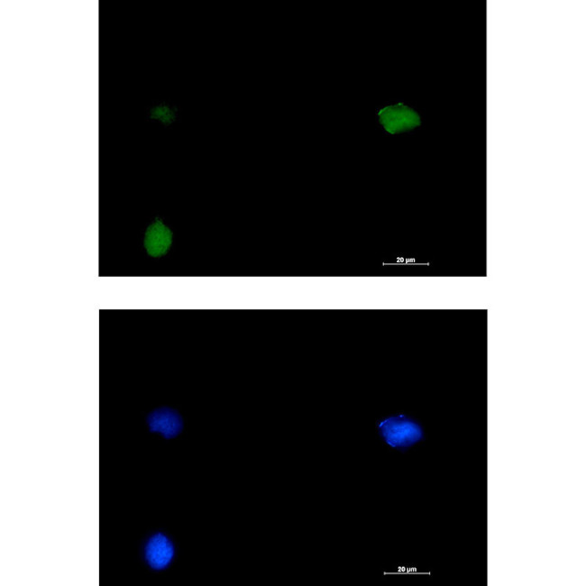 SMARCC1 Antibody in Immunocytochemistry (ICC/IF)