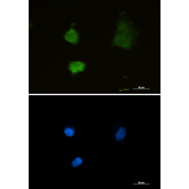 PSMA2 Antibody in Immunocytochemistry (ICC/IF)