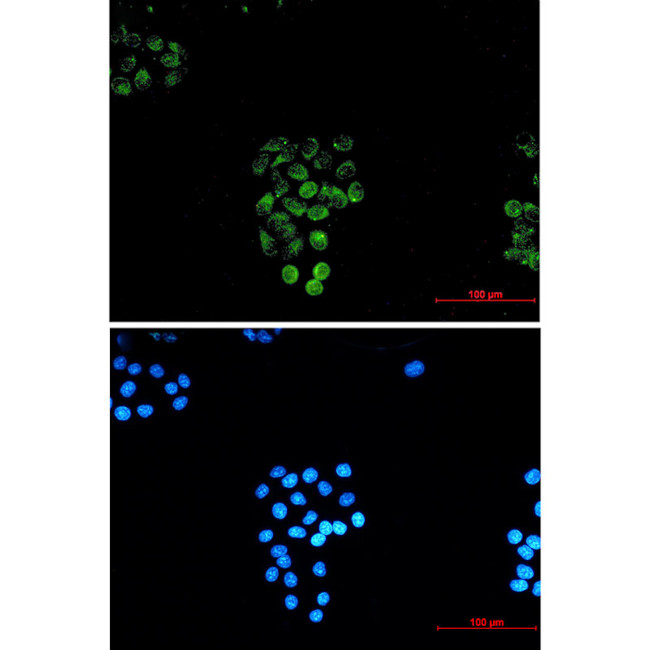 RASEF Antibody in Immunocytochemistry (ICC/IF)