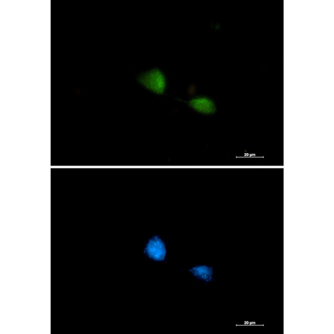 FUBP1 Antibody in Immunocytochemistry (ICC/IF)