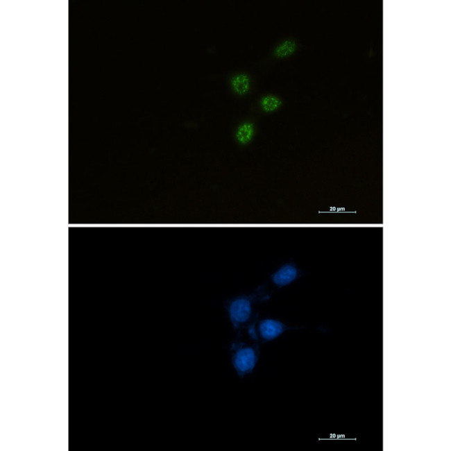 CHK2 Antibody in Immunocytochemistry (ICC/IF)