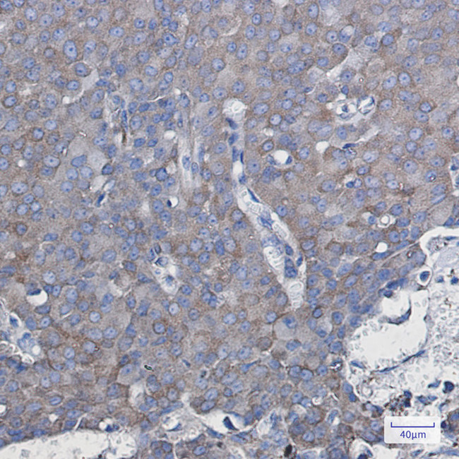NDUFAF5 Antibody in Immunohistochemistry (Paraffin) (IHC (P))