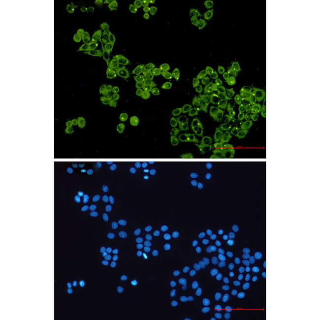 GYS1 Antibody in Immunocytochemistry (ICC/IF)