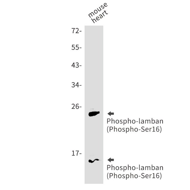 Phospho-Phospholamban (Ser16) Antibody in Western Blot (WB)