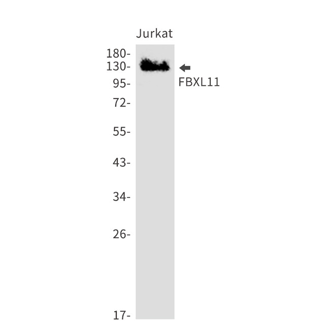 KDM2A Antibody in Western Blot (WB)