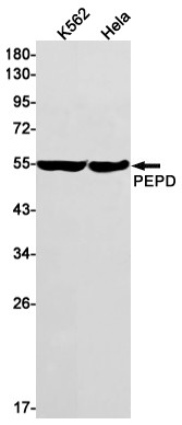 PEPD Antibody in Western Blot (WB)
