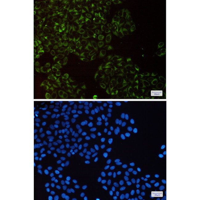 UQCRFS1 Antibody in Immunocytochemistry (ICC/IF)