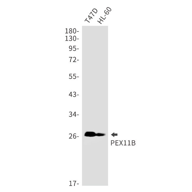 PEX11B Antibody in Western Blot (WB)