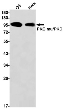 PKC mu Antibody in Western Blot (WB)