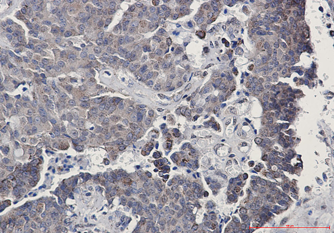 SIRT3 Antibody in Immunohistochemistry (Paraffin) (IHC (P))