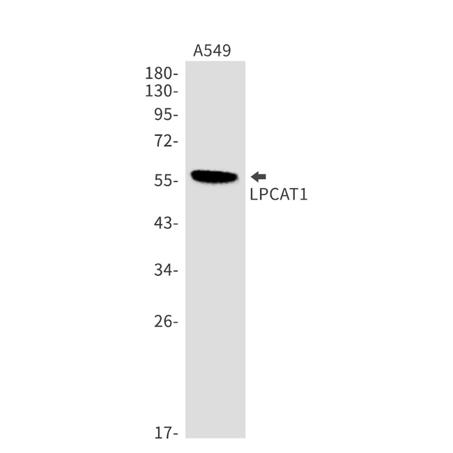 LPCAT1 Antibody in Western Blot (WB)