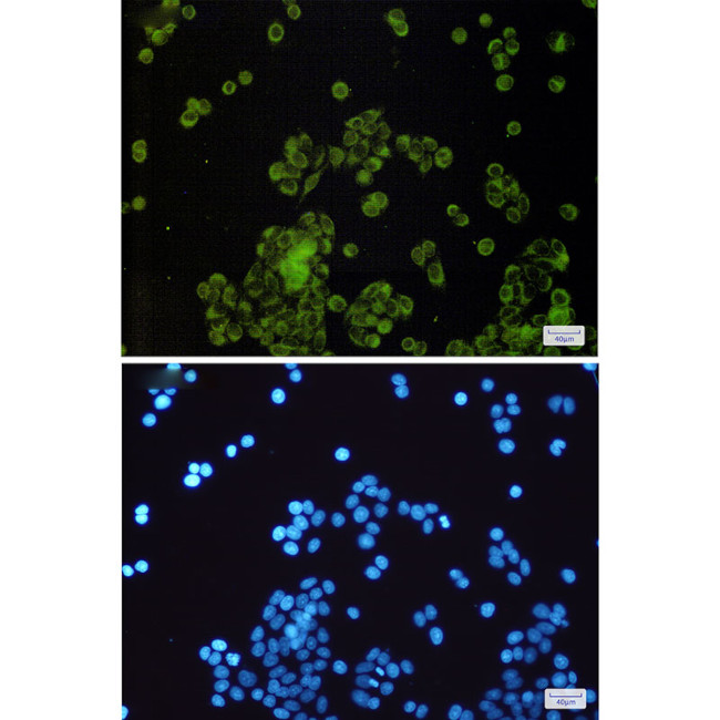 SLC27A4 Antibody in Immunocytochemistry (ICC/IF)