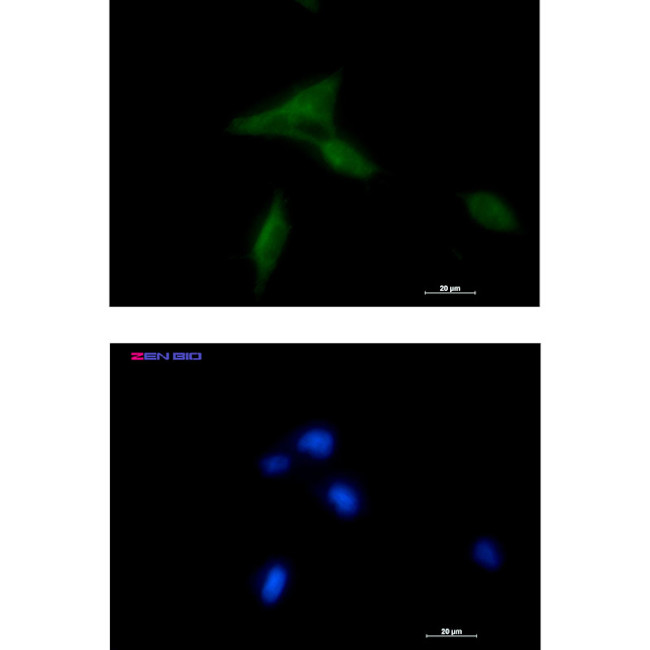 NDUFAF1 Antibody in Immunocytochemistry (ICC/IF)