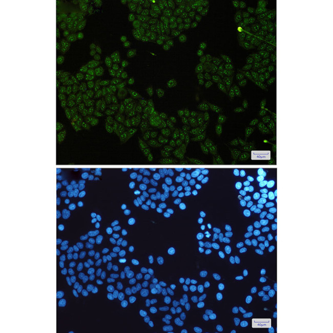 IKK gamma Antibody in Immunocytochemistry (ICC/IF)