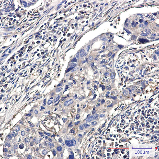 Destrin Antibody in Immunohistochemistry (Paraffin) (IHC (P))