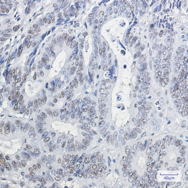 HP1 gamma Antibody in Immunohistochemistry (Paraffin) (IHC (P))