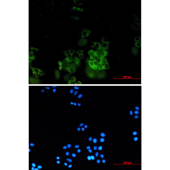 SNX9 Antibody in Immunocytochemistry (ICC/IF)
