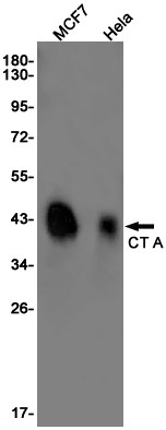 PCYT1A Antibody in Western Blot (WB)