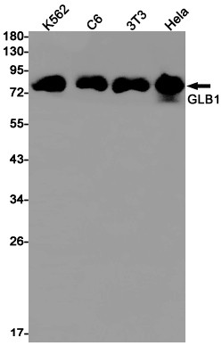 beta Galactosidase Antibody in Western Blot (WB)