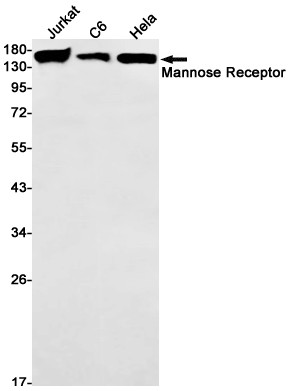 CD206 Antibody in Western Blot (WB)