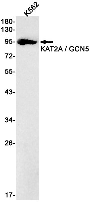 GCN5 Antibody in Western Blot (WB)