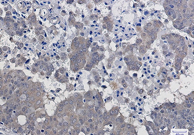 IkB beta Antibody in Immunohistochemistry (Paraffin) (IHC (P))