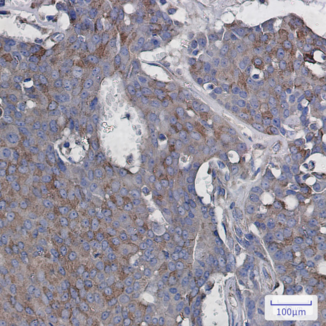 RAC3 Antibody in Immunohistochemistry (Paraffin) (IHC (P))