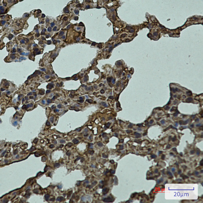 LYVE1 Antibody in Immunohistochemistry (Paraffin) (IHC (P))