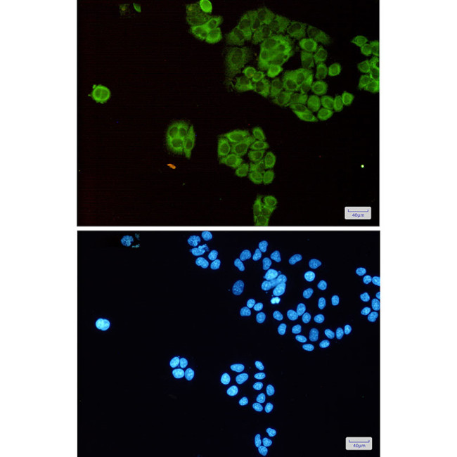 TPT1 Antibody in Immunocytochemistry (ICC/IF)