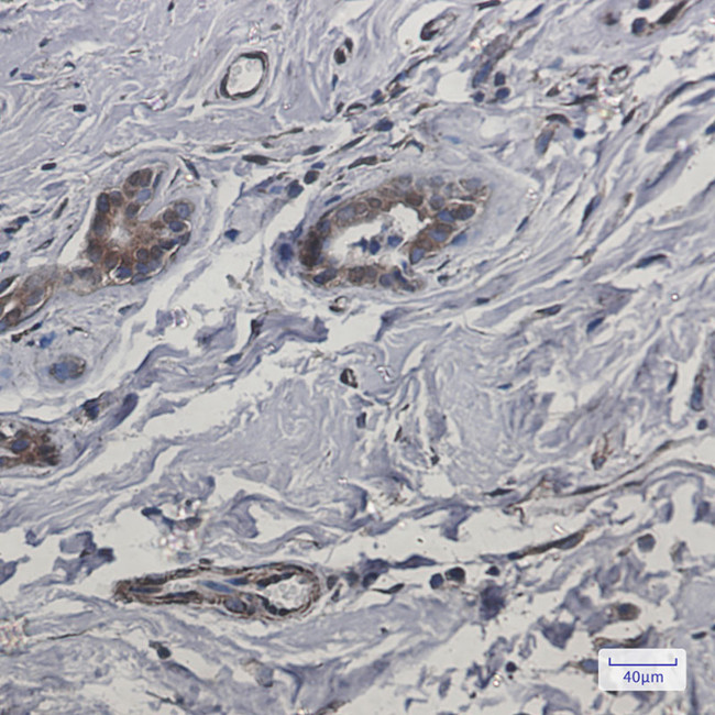 CYB5R3 Antibody in Immunohistochemistry (Paraffin) (IHC (P))